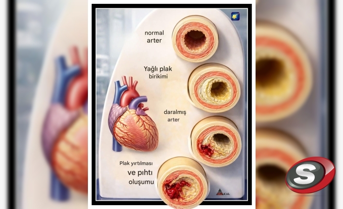 Kardiyolog Ali Erdoğan’dan Hayati Uyarı: Kalp Damarlarınız Sessizce Tıkanıyor Olabilir!