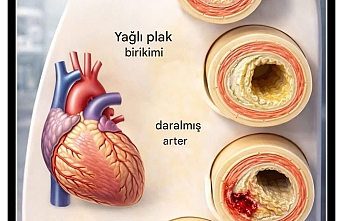 Kardiyolog Ali Erdoğan’dan Hayati Uyarı: Kalp Damarlarınız Sessizce Tıkanıyor Olabilir!