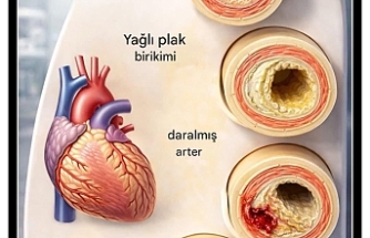 Kardiyolog Ali Erdoğan’dan Hayati Uyarı: Kalp Damarlarınız Sessizce Tıkanıyor Olabilir!