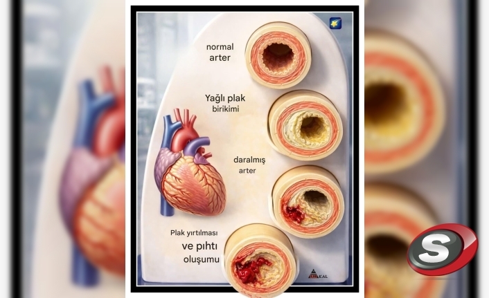 Kardiyolog Ali Erdoğan’dan Hayati Uyarı: Kalp Damarlarınız Sessizce Tıkanıyor Olabilir!